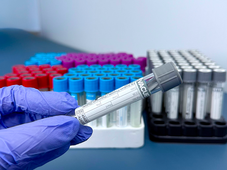 Фотография, иллюстрирующая услугу